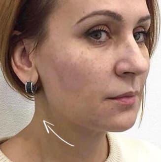 Після нашої процедури