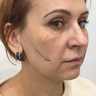 До нашої процедури